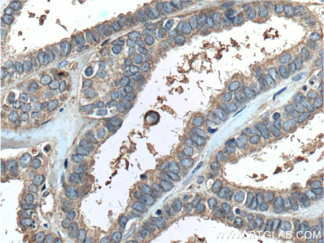 PGRMC1 Antibody in Immunohistochemistry (Paraffin) (IHC (P))