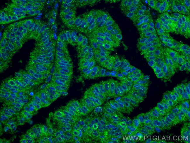 PGRMC1 Antibody in Immunohistochemistry (PFA fixed) (IHC (PFA))