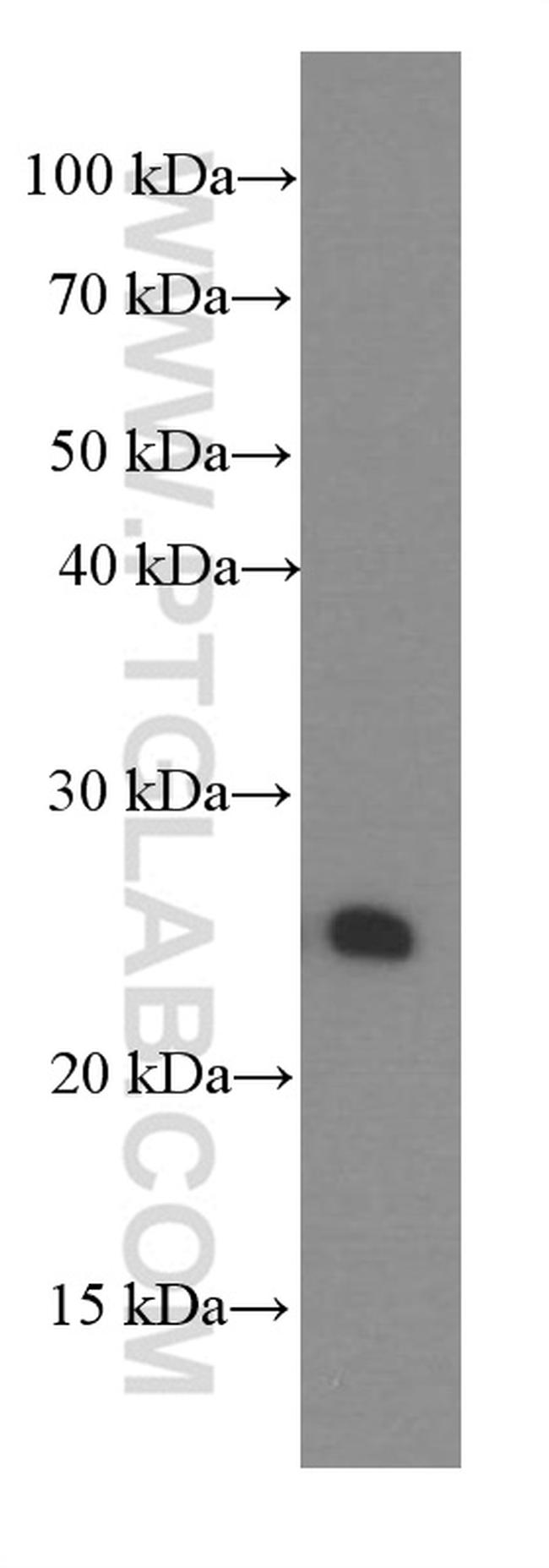 PGRMC1 Antibody in Western Blot (WB)