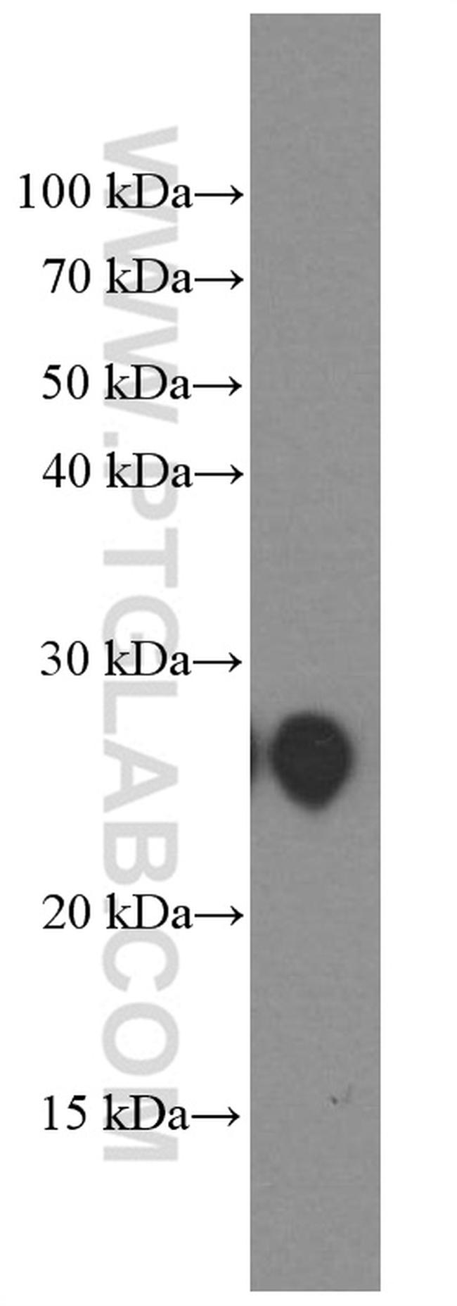 PGRMC1 Antibody in Western Blot (WB)