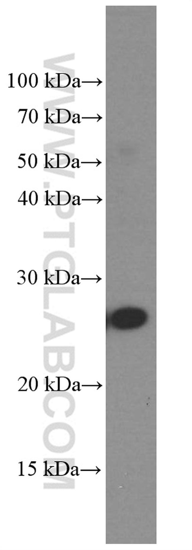 PGRMC1 Antibody in Western Blot (WB)