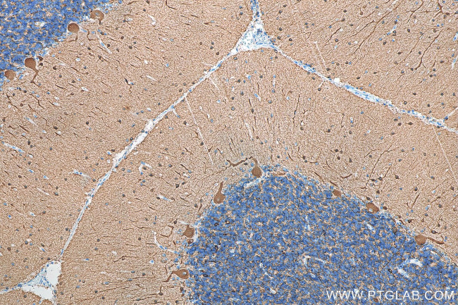 TUBB3 Antibody in Immunohistochemistry (Paraffin) (IHC (P))