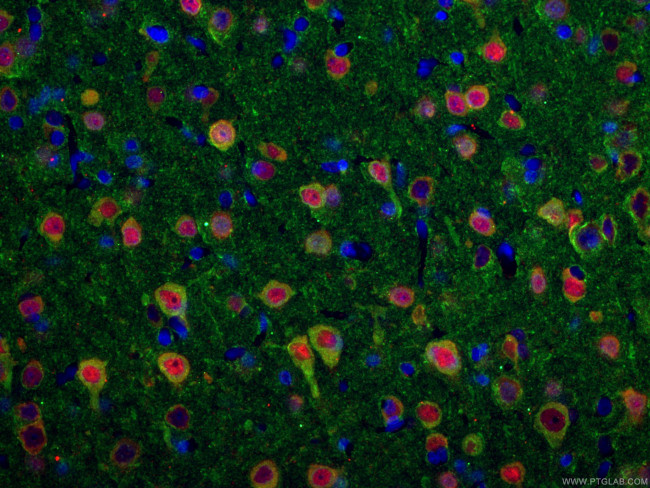 TUBB3 Antibody in Immunohistochemistry (PFA fixed) (IHC (PFA))