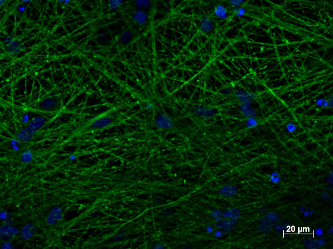 TUBB3 Antibody in Immunocytochemistry (ICC/IF)