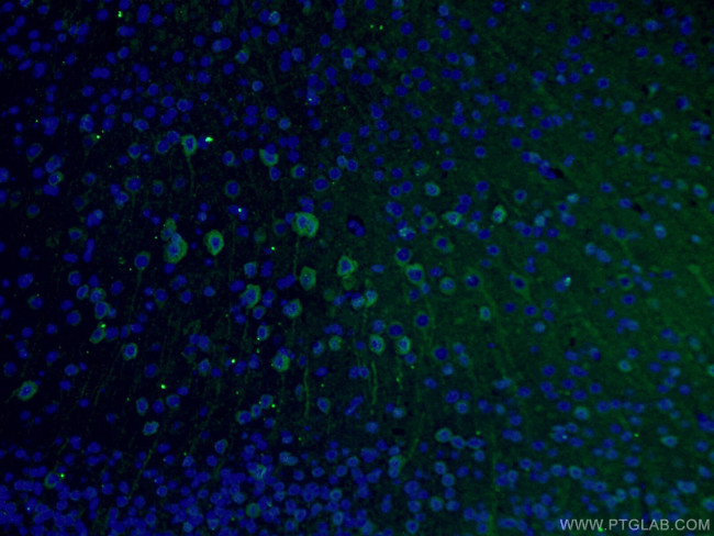 TUBB3 Antibody in Immunohistochemistry (PFA fixed) (IHC (PFA))