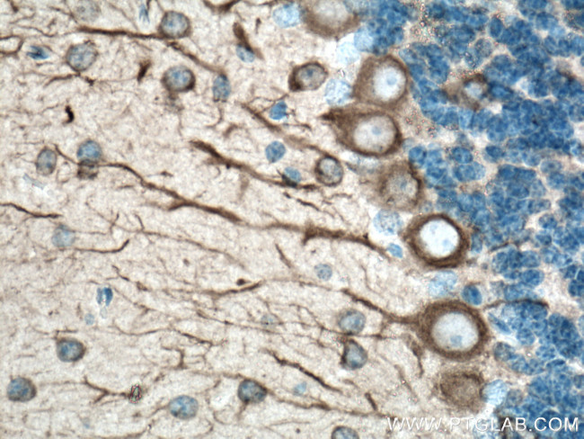 TUBB3 Antibody in Immunohistochemistry (Paraffin) (IHC (P))