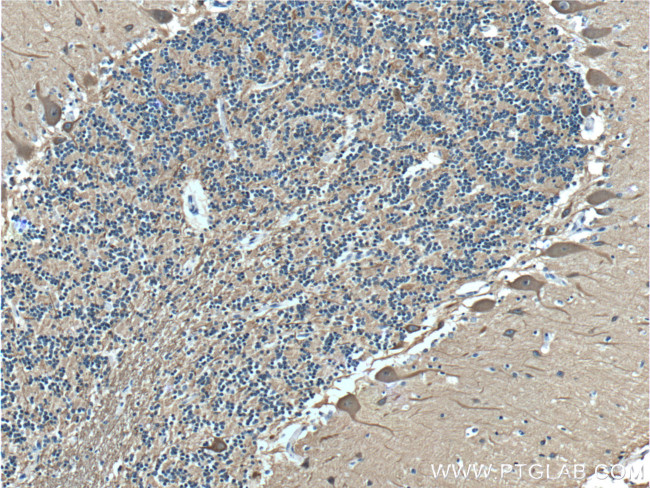 TUBB3 Antibody in Immunohistochemistry (Paraffin) (IHC (P))