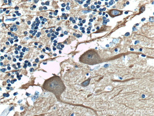 TUBB3 Antibody in Immunohistochemistry (Paraffin) (IHC (P))