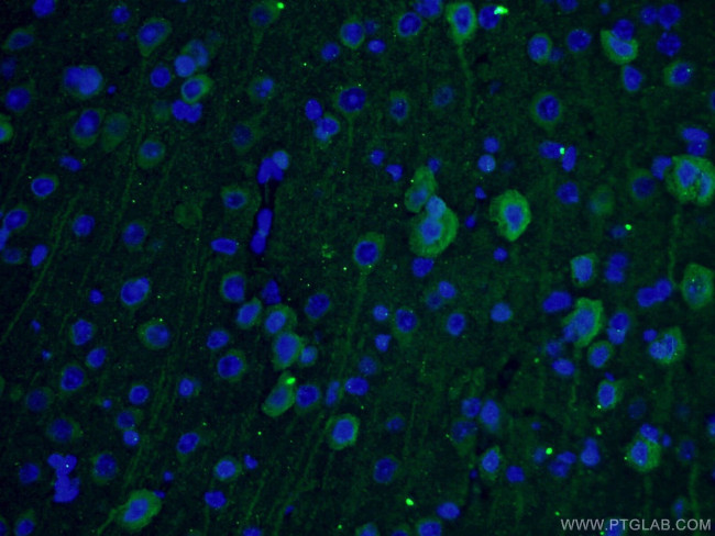 TUBB3 Antibody in Immunohistochemistry (PFA fixed) (IHC (PFA))