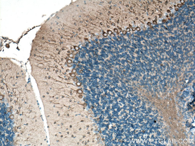 TUBB3 Antibody in Immunohistochemistry (Paraffin) (IHC (P))