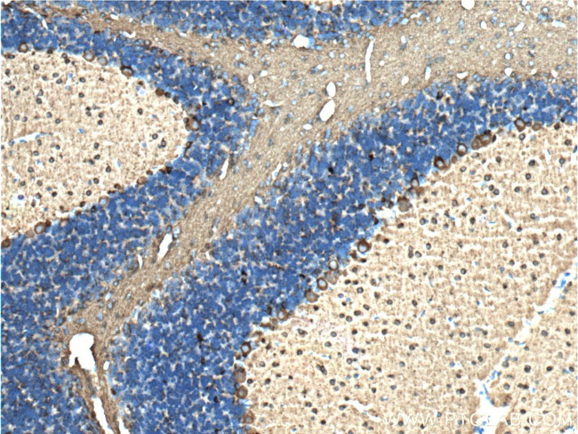 TUBB3 Antibody in Immunohistochemistry (Paraffin) (IHC (P))