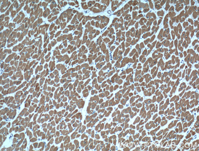 Cardiac Troponin I Antibody in Immunohistochemistry (Paraffin) (IHC (P))