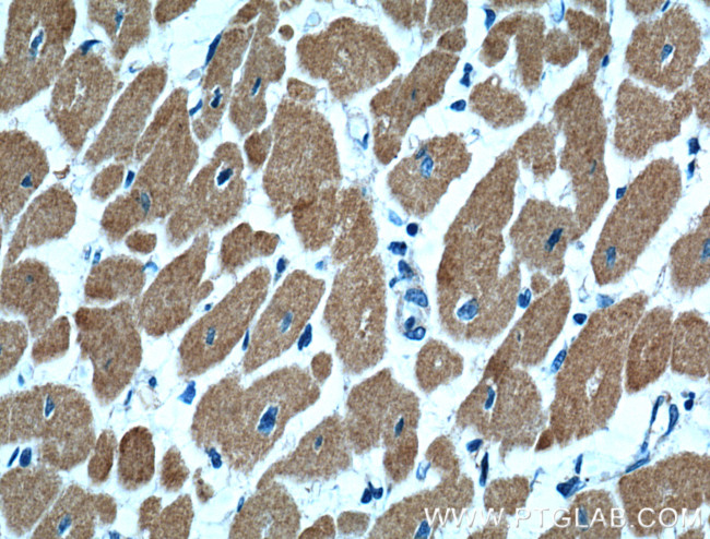 Cardiac Troponin I Antibody in Immunohistochemistry (Paraffin) (IHC (P))