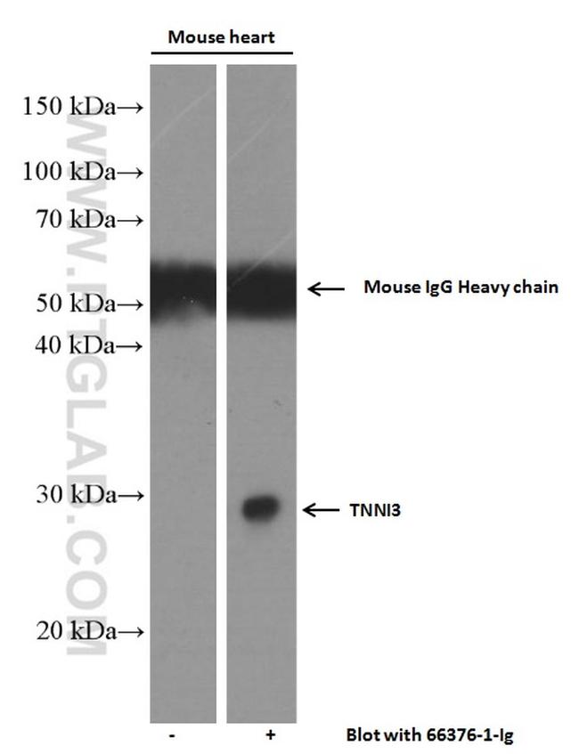 Cardiac Troponin I Antibody in Western Blot (WB)