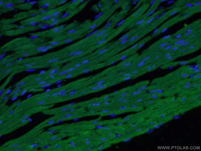 Cardiac Troponin I Antibody in Immunohistochemistry (PFA fixed) (IHC (PFA))