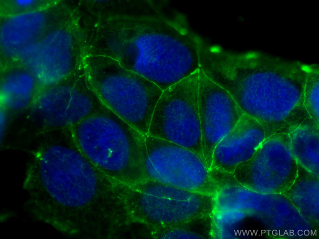 Occludin Antibody in Immunocytochemistry (ICC/IF)