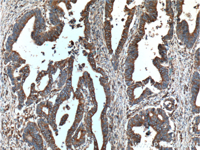 Occludin Antibody in Immunohistochemistry (Paraffin) (IHC (P))