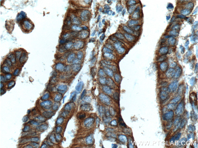 Occludin Antibody in Immunohistochemistry (Paraffin) (IHC (P))