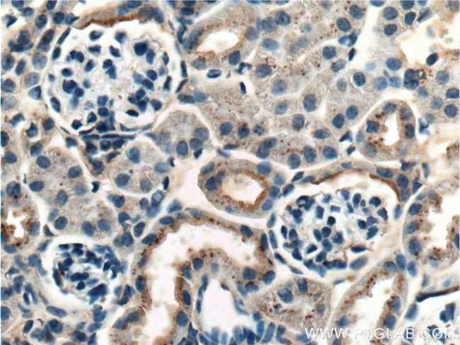 Occludin Antibody in Immunohistochemistry (Paraffin) (IHC (P))