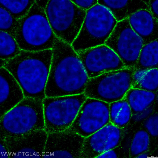 beta-Catenin Antibody in Immunocytochemistry (ICC/IF)