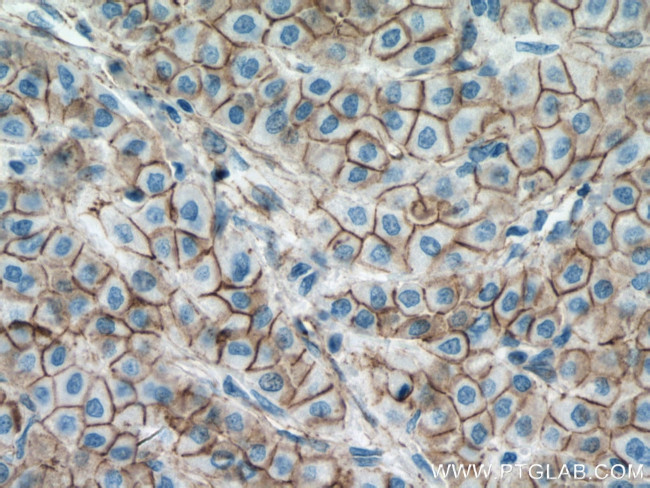 beta-Catenin Antibody in Immunohistochemistry (Paraffin) (IHC (P))