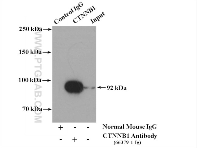 beta-Catenin Antibody in Immunoprecipitation (IP)
