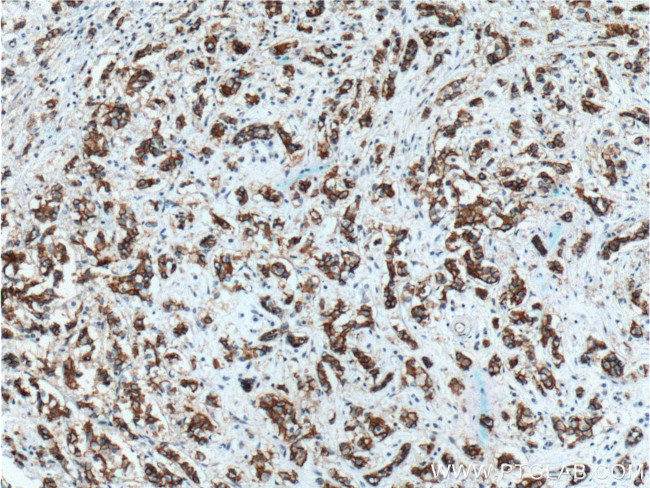 beta-Catenin Antibody in Immunohistochemistry (Paraffin) (IHC (P))