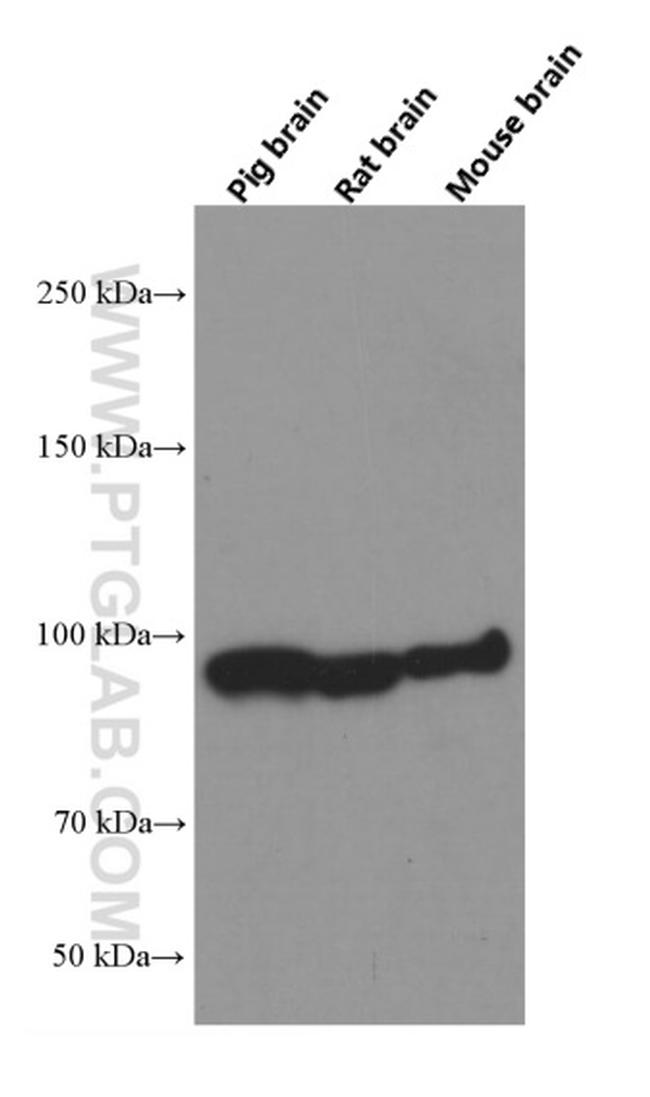 beta-Catenin Antibody in Western Blot (WB)