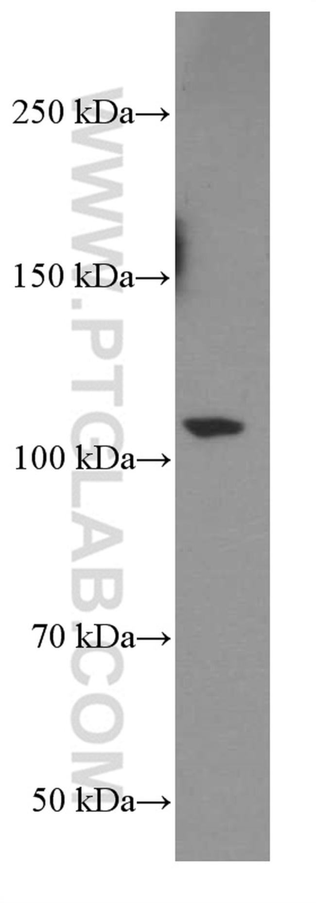 TrkC Antibody in Western Blot (WB)