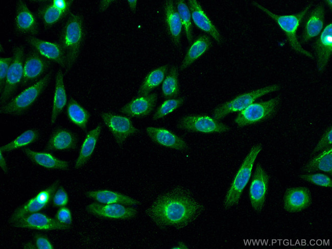 SLCO1B3 Antibody in Immunocytochemistry (ICC/IF)