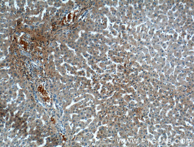 OGN Antibody in Immunohistochemistry (Paraffin) (IHC (P))