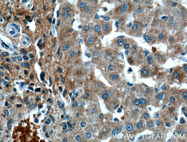 OGN Antibody in Immunohistochemistry (Paraffin) (IHC (P))