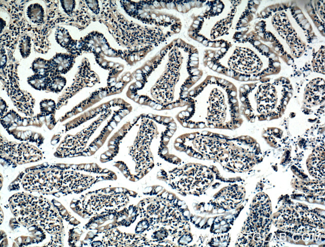 BMP2 Antibody in Immunohistochemistry (Paraffin) (IHC (P))