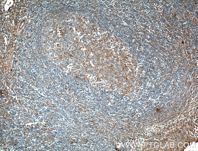 MICA Antibody in Immunohistochemistry (Paraffin) (IHC (P))