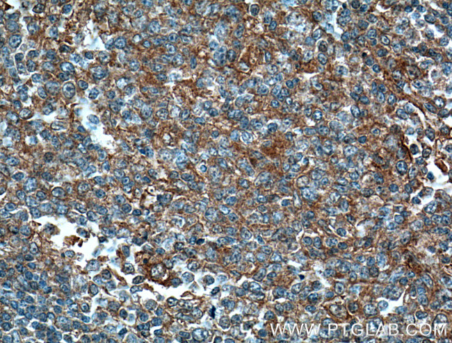 MICA Antibody in Immunohistochemistry (Paraffin) (IHC (P))