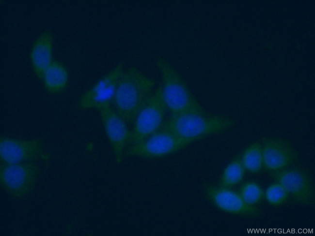 NAMPT/PBEF Antibody in Immunocytochemistry (ICC/IF)