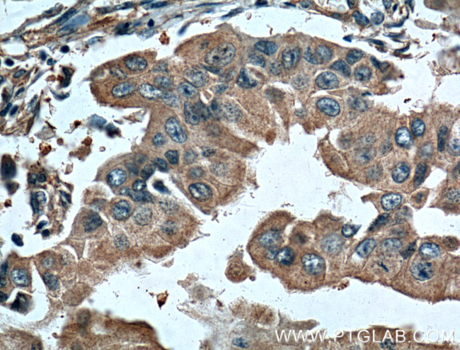 NAMPT/PBEF Antibody in Immunohistochemistry (Paraffin) (IHC (P))