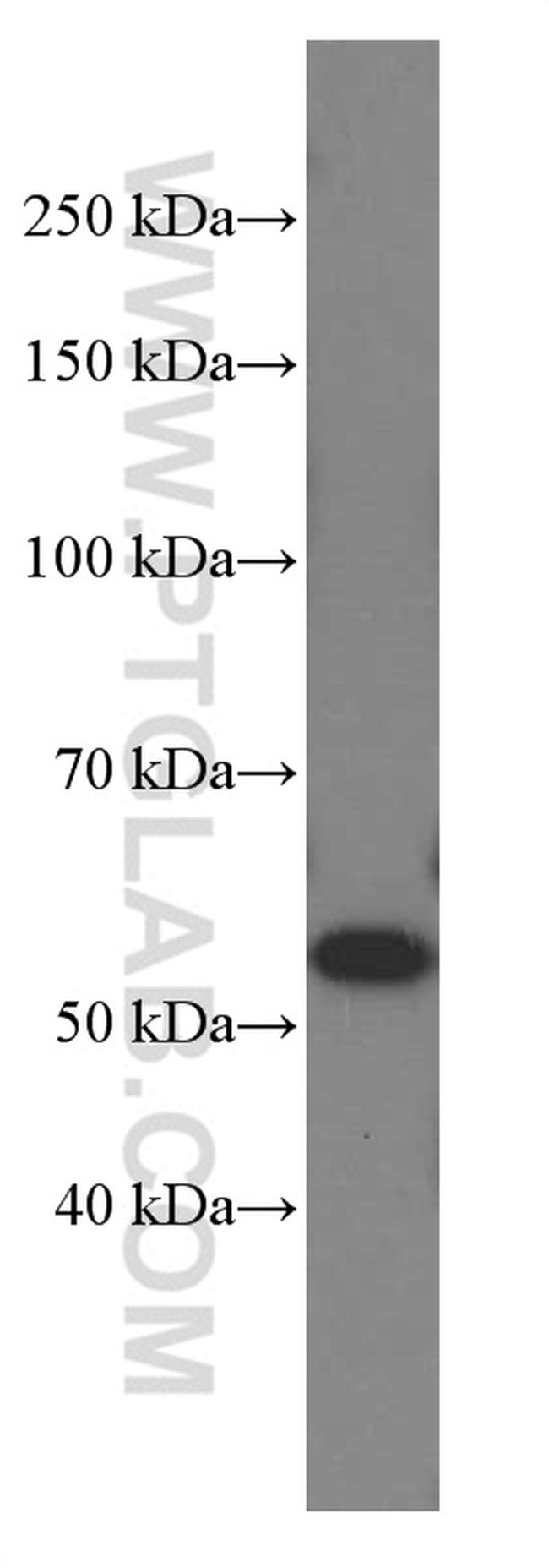 NAMPT/PBEF Antibody in Western Blot (WB)