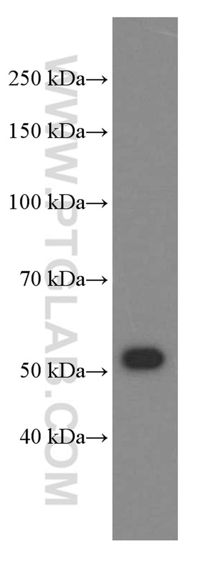 NAMPT/PBEF Antibody in Western Blot (WB)