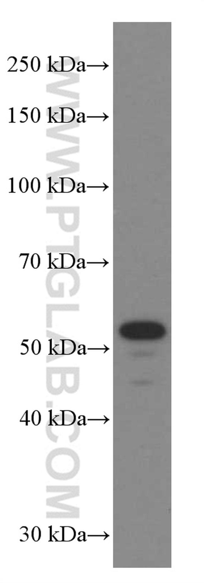 NAMPT/PBEF Antibody in Western Blot (WB)