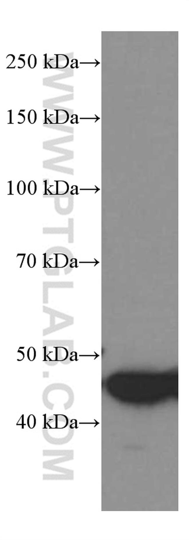 GSDMD Antibody in Western Blot (WB)