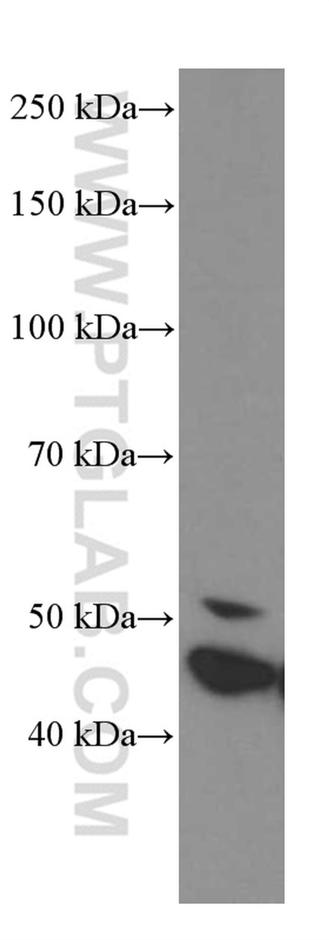 GSDMD Antibody in Western Blot (WB)