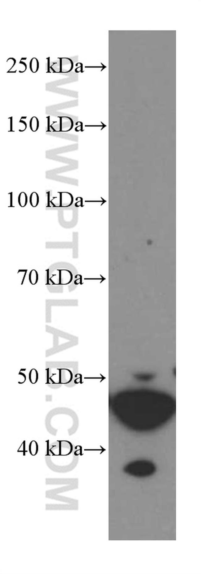 GSDMD Antibody in Western Blot (WB)