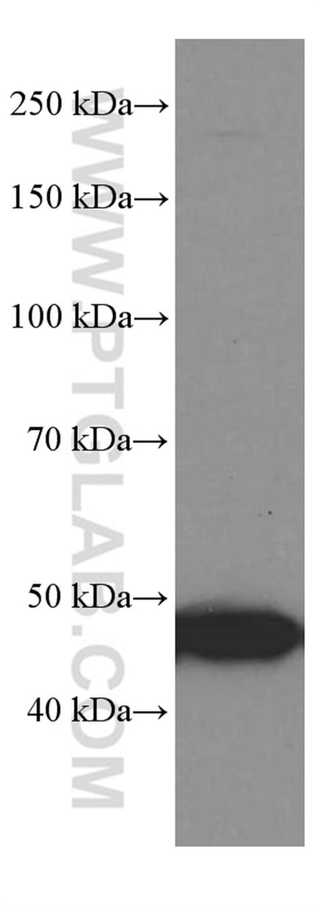 GSDMD Antibody in Western Blot (WB)