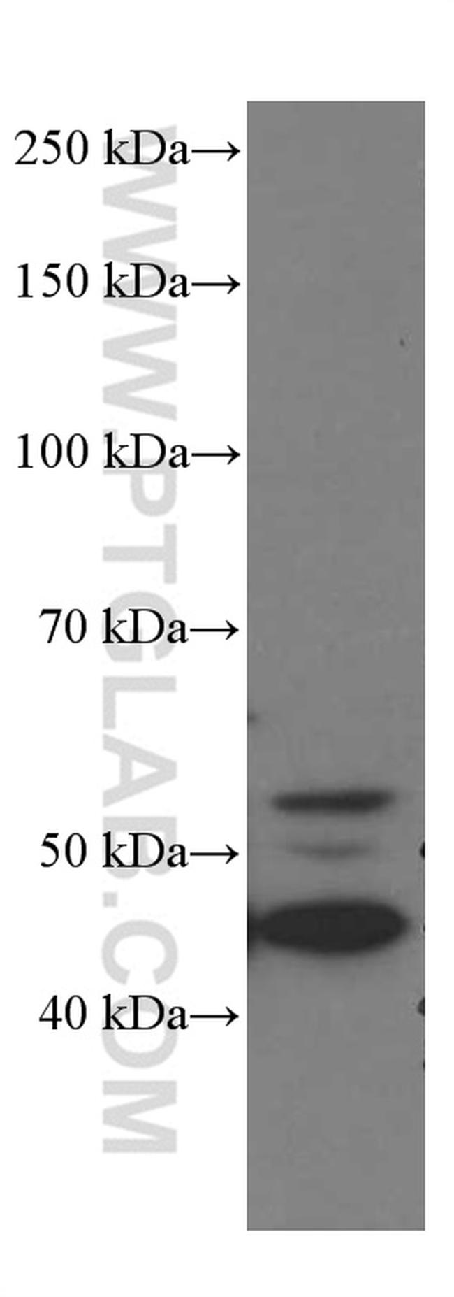 GSDMD Antibody in Western Blot (WB)