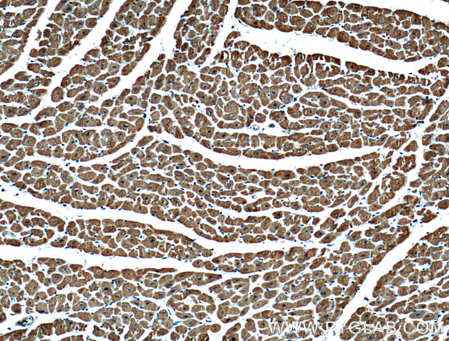 VDAC2 Antibody in Immunohistochemistry (Paraffin) (IHC (P))