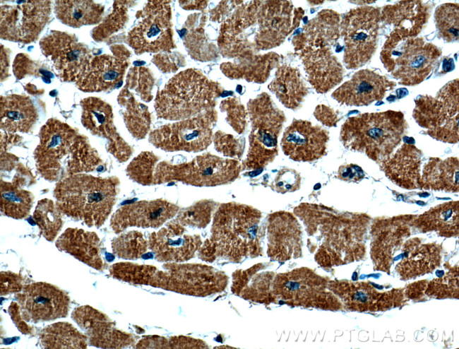 VDAC2 Antibody in Immunohistochemistry (Paraffin) (IHC (P))