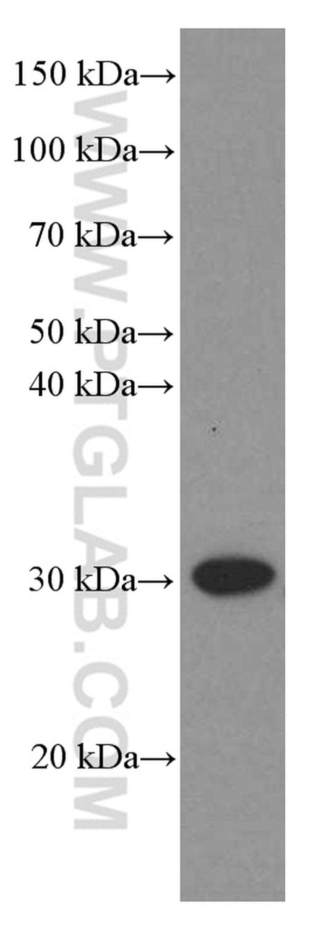 VDAC2 Antibody in Western Blot (WB)