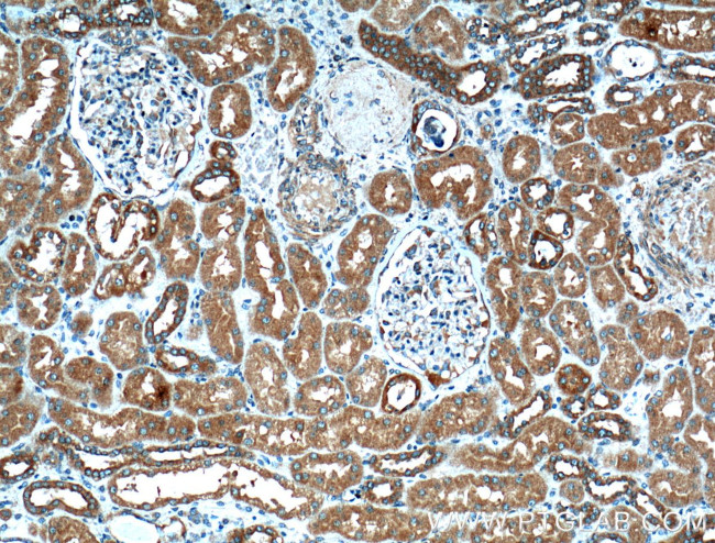 VDAC2 Antibody in Immunohistochemistry (Paraffin) (IHC (P))