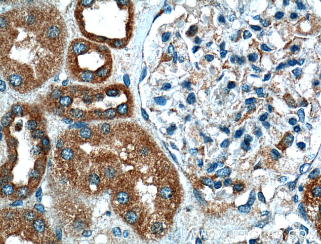 VDAC2 Antibody in Immunohistochemistry (Paraffin) (IHC (P))